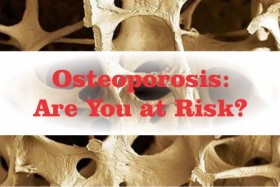 Osteoporosis: Are You at Risk?